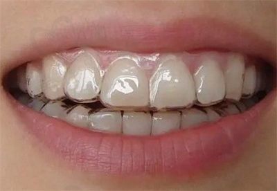 金华哪家儿童牙科医院好?这份金华儿童口腔医院排名榜告诉你!